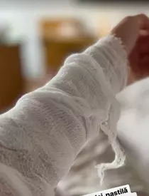 Irina Fodor a avut nevoie de ajutorul medicilor