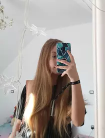 "Ești simbolul triumfului vieții şi a binelui!" Cum arată și cum se simte Alexia, fata de 15 ani căreia i-au fost replantate brațele acum patru luni