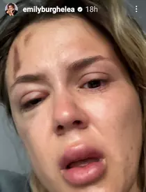 emily-burghelea200-1