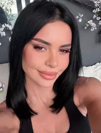 Andreea Popescu dupa operatiile estetice2