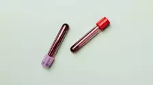 Somn, stres, mișcare: cum se văd obiceiurile tale în analize, cu Clinica Sante