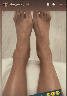 Alina Puscas s-a lovit la piciir