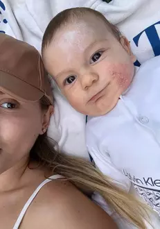 Ce probleme de sănătate are fiul lui Emily Burghelea, la doar 4 luni: 'Nu știu ce să mai facem cu dermatita atopică. O să intru în depresie'