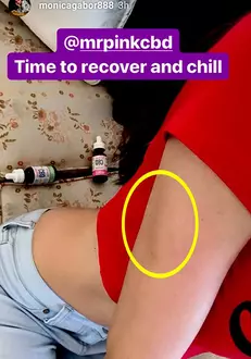 Monica Gabor are vânătăi pe corp