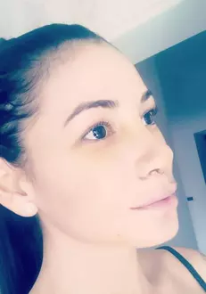 Roxana Vancea, dupa operatia la nas