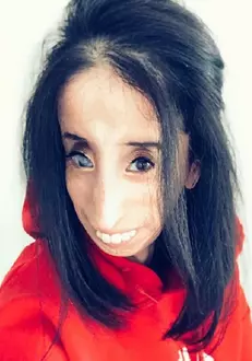 Lizzie Velasquez