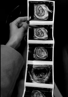 Alina-Ceușan-însărcinată-1