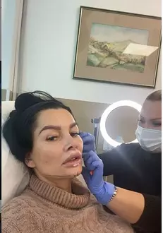 Brigitte-Pastramă-intervenție-estetică-față-1