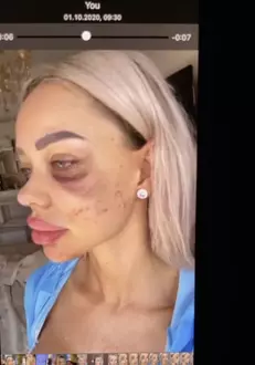 Bianca-Dragusanu-batuta-10-576×1024