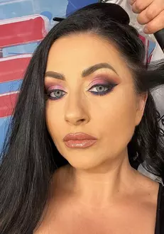 Gabriela-Cristea-interventie-estetica-1