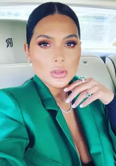 roxana-dobre-interventie-estetica-1