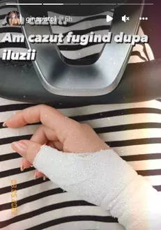 Gina cu mana bandajata