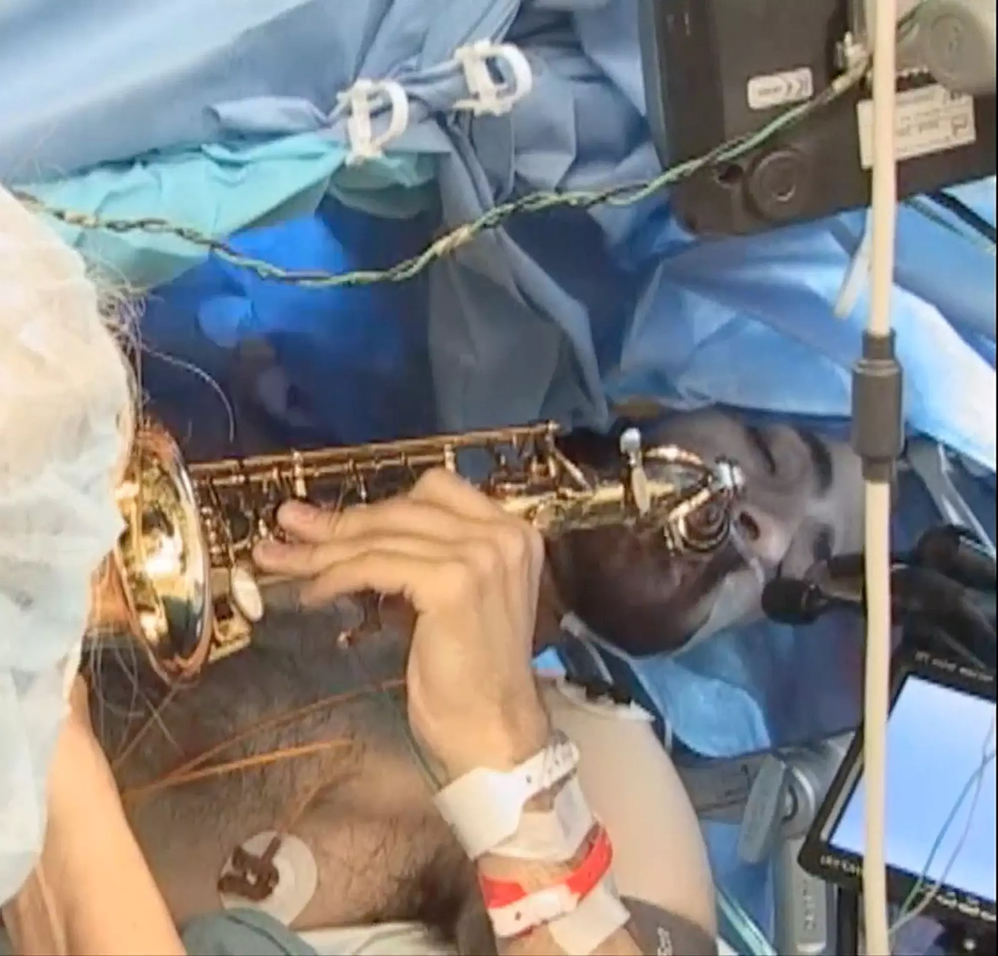 Musician plays sax during brain surgery to prove his skills are