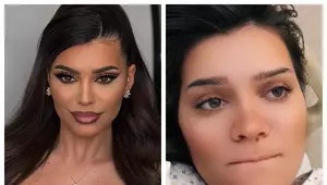 Influencerița Bee, dezvăluiri șocante despre ce i s-a întâmplat în spitalul din Constanța. "Cer să nu fiu lăsată să aștept până când durerea devine normalitate!" Calvarul prin care a trecut