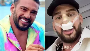 Dorian Popa a fost operat de urgență la nas. Intervenția chirurgicală a durat 6 ore: „Mi-a scos din coastă o bucată de vreo 5 cm. Aveam osul spină lipsă”