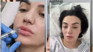 Ana Morodan, adevărul despre intervențiile estetice suferite. Vedeta a mers până în pânzele albe ca să arate așa cum își dorește