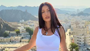 Alina Eremia, cu fața tumefiată și ochii umflați. Artista a ajuns de urgență la spital: „Am făcut tratament perfuzabil”