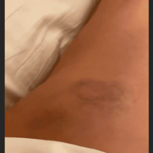 Asa-arata-vedeta-dupa-cazatura-300x300