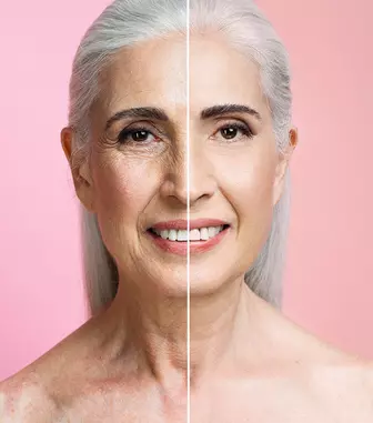 Rejuvenarea facială după 30, 40 și 50 de ani ce tratamente pot fi potrivite în funcție de vârstă și tipul de ten