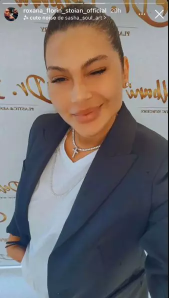 roxana-dobre-interventie-estetica-111