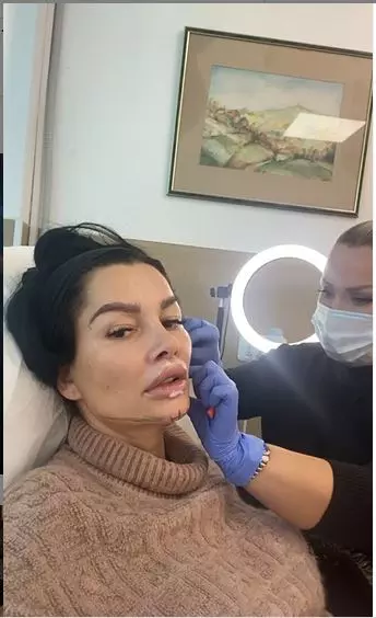 Brigitte-Pastramă-intervenție-estetică-față-1