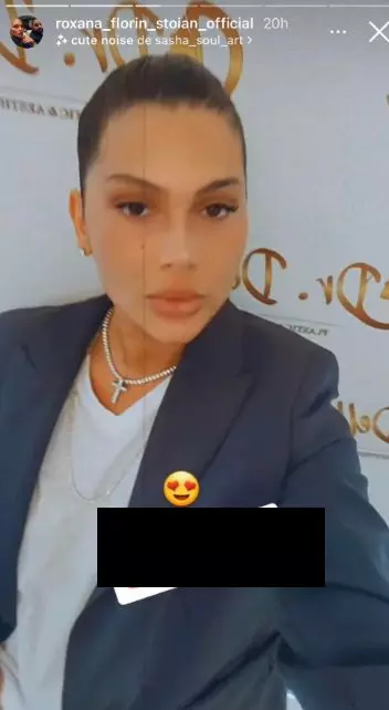 roxana-dobre-interventie-estetica-123