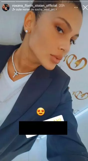 roxana-dobre-interventie-estetica-122