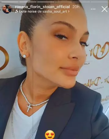 roxana-dobre-interventie-estetica-124