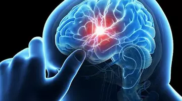 O boală extrem de comună care poate dubla riscul de AVC