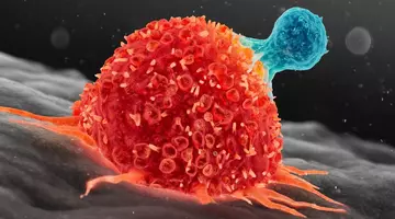 Cancerul metastatic a dispărut după doar două doze dintr-o nouă terapie. Rezultatul care îi uimește pe medici