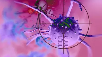 Medic oncolog: „Aproximativ 40% dintre cazurile de cancer pot fi prevenite”