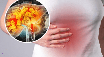 Unde doare ficatul. Ce spun medicii și ce poți face imediat