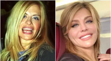 Cum arăta Loredana Groza în anul 1995. Artista susține că nu a apelat la medicul estetician, dar imaginile spun altceva