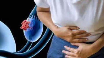 Johnson & Johnson plătește 5,5 miliarde de dolari pentru a închide procesele privind acuzațiile legate de pudra de talc și cancerul ovarian