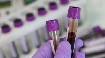 Analize și investigații medicale gratuite în 2026