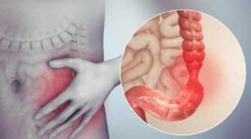 Semnul neașteptat al cancerului de colon pe care mulți îl observă la toaletă și îl ignoră