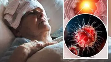 Alertă medicală: epidemie de dengue în explozie. Peste 42.000 de oameni au ajuns la spital