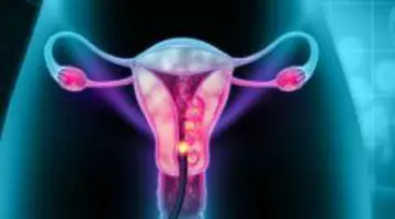 Testul pentru cancer de col uterin pe care femeile îl pot face singure acasă