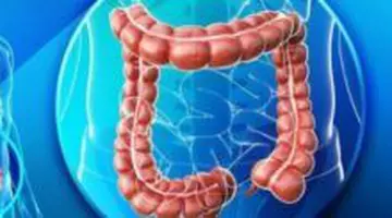 Tot mai mulți tineri fac cancer de colon. Simptomele pe care nu ai voie să le ignori, chiar dacă ai sub 40 de ani