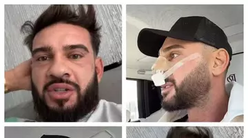 Un vis estetic transformat în luptă pentru sănătate. Prin ce a trecut Dorian Popa pe masa de operație