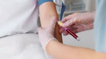 Testul de sânge care a depistat toate cazurile de cancer de colon