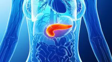 Un semn de cancer pancreatic poate apărea când mergi la toaletă, chiar și în faze incipiente