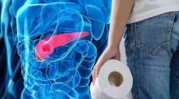 Semnul cancerului pancreatic pe care îl poți observa în toaleta după ce tragi apa