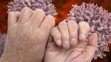 5 semne de alarmă ale hipotiroidismului care pot apărea pe unghii. Ce transmite corpul înainte să apară simptomele grave