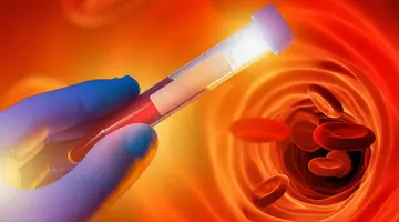 Medicul hematolog spune ce vitamine ajută sănătatea sângelui. Obiceiurile care cresc riscul de îmbolnăvire