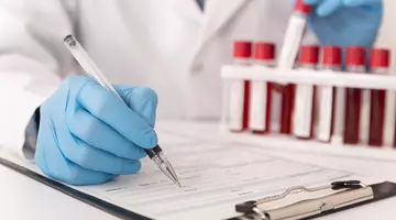 Un indicator din setul de analize uzuale ar putea semnala riscul de Alzheimer înainte de apariția simptomelor