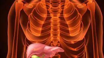 „Am eliminat 20 de pietre la fiere după ulei cu lămâie.” Ce sunt, de fapt, „pietrele” din gallbladder flush și cum se tratează corect litiaza biliară