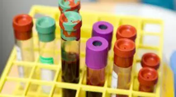 Sfârșitul cozilor la analize: CNAS promite acces continuu la investigații decontate