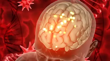 De ce COVID-19 nu e „doar o gripă”. Inflamație cerebrală persistentă, chiar și după forme ușoare