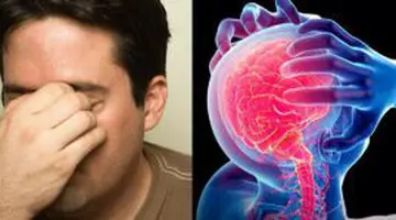 Durerea de cap care te trimite direct la spital. Semnele ignorate care pot ascunde un pericol real